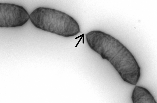 Lactobacillus rhamnosus