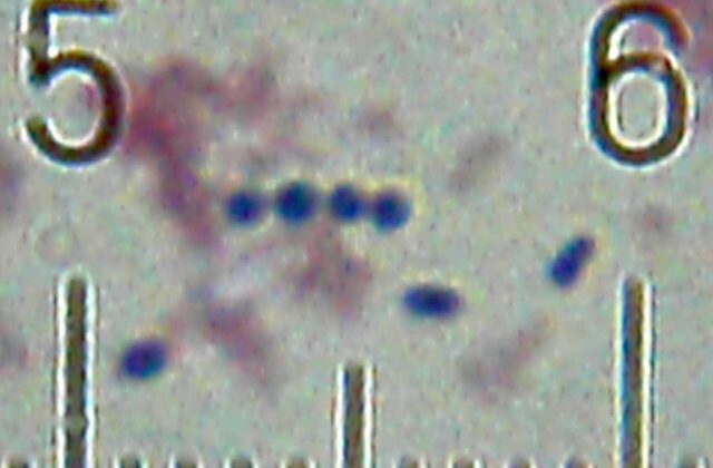 Streptococcus thermophilus